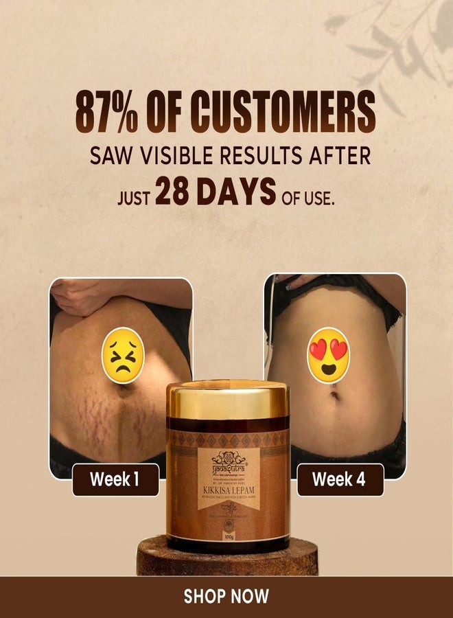 YADASUTRA Ayurvedic Stretch Mark Cream For Pregnancy - 100g Kikkisa Lepam Skin Nourishing Hydration Scar Fade - Image 2