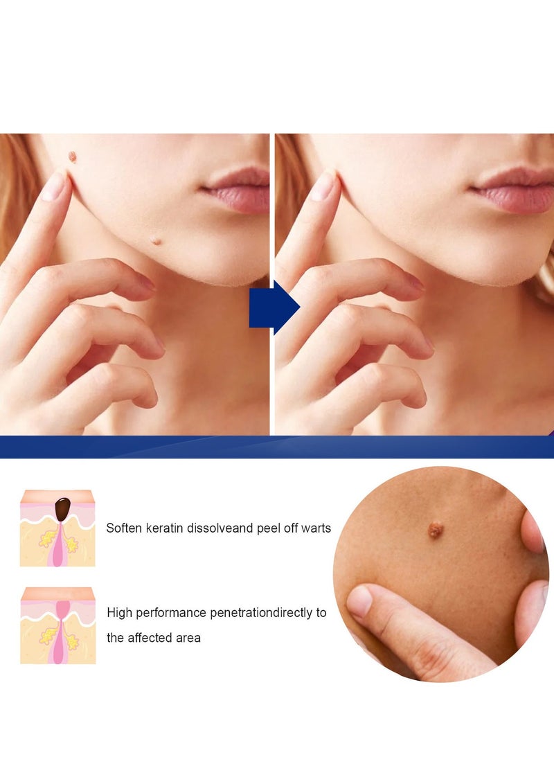 EELHOE Wart Removal Ointment Cream Skin Treatment With Natural Herbal Ingredients for The Treatment Of Common Warts Effective And Safe 20g - Image 3