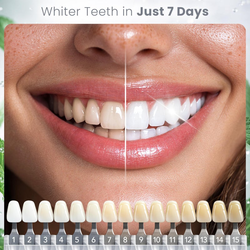 Glowee Gentle Teeth Whitening Strips - (14 Strips) Bleaching Teeth Free of Peroxide for a Radiant Smile - Gentle Tooth Whitening - 7 Applications - Image 3