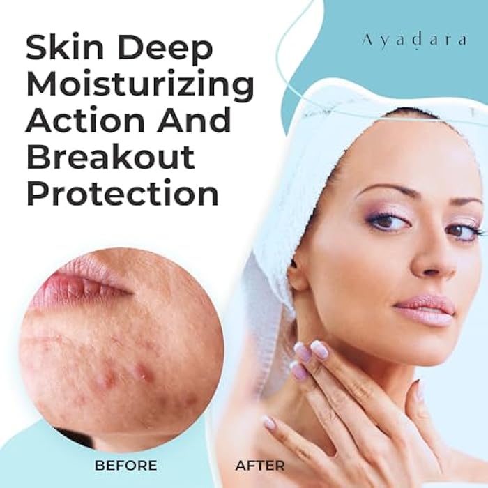 AYADARA Moisturizing Acne Cream, Salicylic Acid Face Moisturizer for Oily & Acne-Prone Skin, Helps with Pimples, Blackheads, Whiteheads, Hormonal & Cystic Acne, for Men and Women, 90-Day Supply by Ayadara - Image 4
