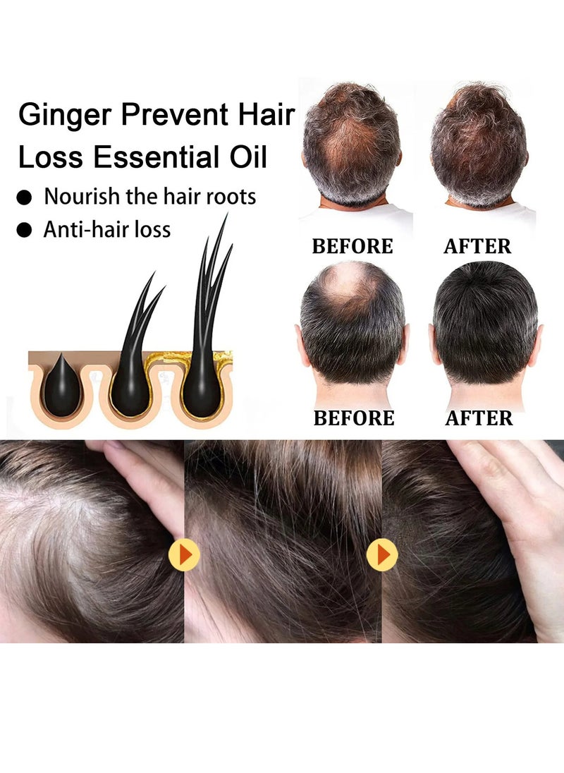 OUHOE - Ginger Hair Dense Essential Oil, Anti Hair Loss Germinal Ginger Hair Growth Oil, Moisturizing Scalp Treatment Hair Enhance Oil, Nourshing Hair Growth Essence For Hair Repair - Image 1
