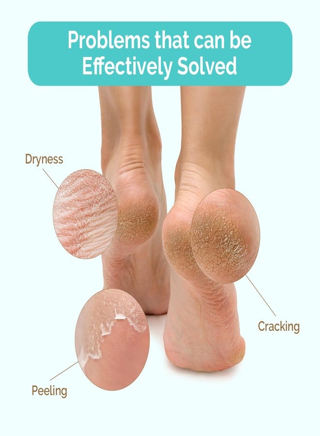 MelodySusie Moisturizing Socks-Gel Silicone Rose Socks, Infused with Vitamin E & JoJoba Oil - Self Care S Gifts for Women Foot Care 1 Pairs - Image 2