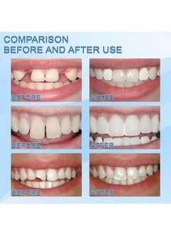 Jaysuing Moldable False Teeth,White Particles Reusable Non-toxic Temporarily Fill 30ml  - Image 3