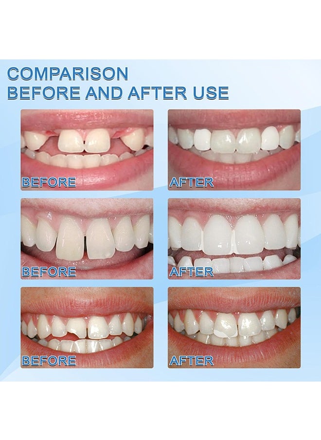 Jaysuing Moldable False Teeth,White Particles Reusable Non-toxic Temporarily Fill 30ml  - Image 3