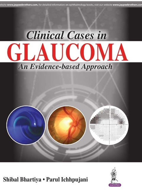 Jaypee Brothers Medical Publishers Clinical Cases in Glaucoma: An Evidence Based Approach