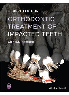 Orthodontic Treatment of Impacted Teeth 