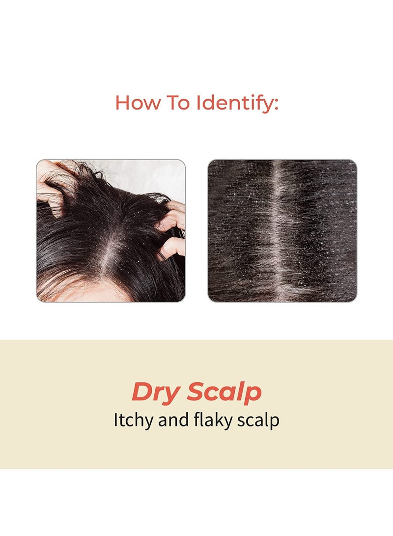 Vedix Customised Ayurvedic Hair Fall Oil | Vedix Shvedan Hair Fall Oil | For Dry Scalp | With Castor + Sesame + Olive | For Reducing Hair Fall | For Hair Growth | -100ml - Image 5