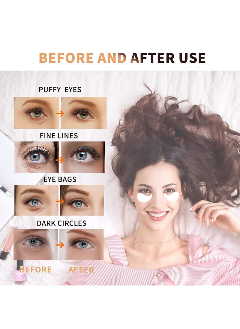 AUROMA 4Pcs Eye Masks for Dark Circles and Puffiness,  Under Eye Patches for Puffy Eyes Treatment, Under Eye Gel Pads Collagen for Eye Bags Treatment, Gel Eye Mask Skincare, White  - Image 3