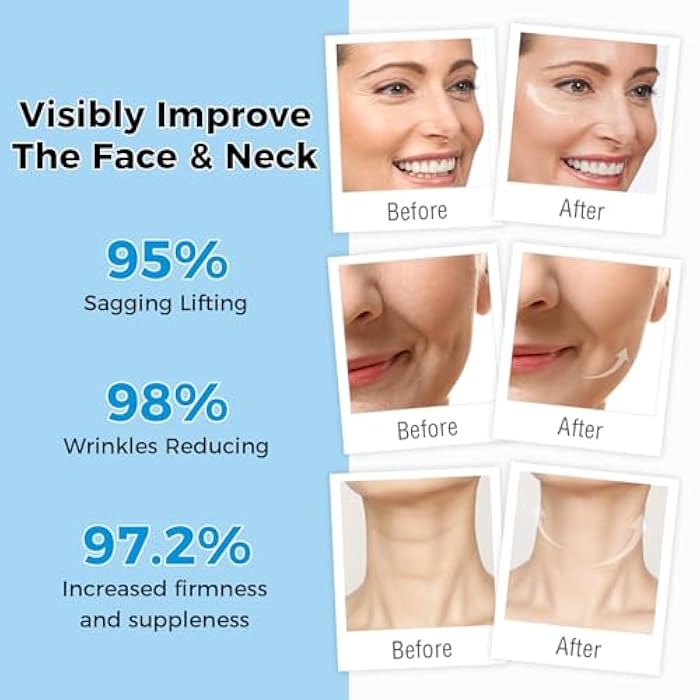 OUKEYA Retinol Cream for Face,Wrinkle for Women, Anti-Aging Moisturizer, Neck Firming & Décolleté, Moisturizer Face Cream, Day Night with 5% Hyaluronic Acid - Image 4