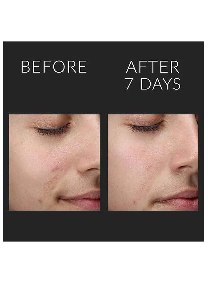 Kate Somerville Liquid ExfoliKate Triple Acid Resurfacing Treatment 120ml 4 fl oz - Image 5