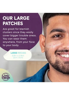LivaClean LivaClean 50CT Large Hydrocolloid Acne Patches - for Pore Spots Nose Face Cystic Pimple Zit Patch - Big Pimple Patches Hydrocolloid Bandages Strips Stickers Pimple Patch XL Large Acne Patch Large  - Image 4