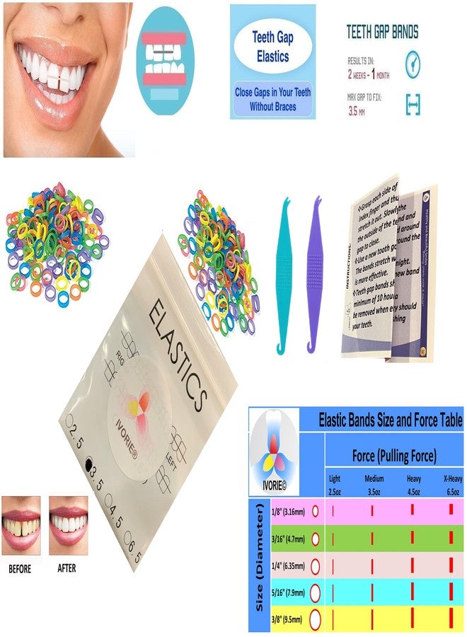 IVORIE Dental Ortho Elastic Rubber Bands Mixed Colors 100 Pack Teeth Gap Closing (3/16" X-Heavy 6.5oz) - Image 2