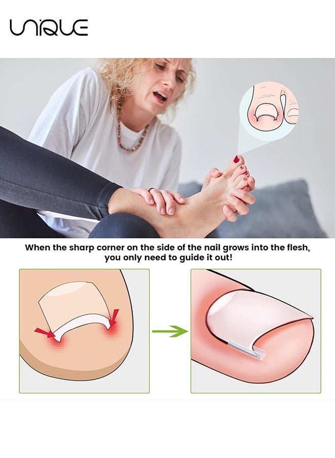 Unique 60 Pieces IIngrown Toenail Corrector Set - Strips Ingrown Toe Nail Correction Brace Correction Clip Toe Nail Straightening Recover Patch Curved Toenail Corrector for Women Men Foot Care - Clear - Image 3