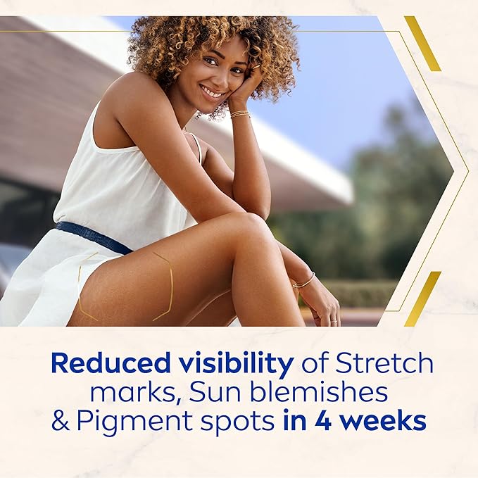 Nivea كريم نيفيا لومي نوس 630 المضاد لعلامات التمدد والبقع الداكنة 200 مل كريم مرطب لمدة 48 ساعة يقلل من علامات التمدد والبقع الشمسية والبقع الصبغية - Image 2