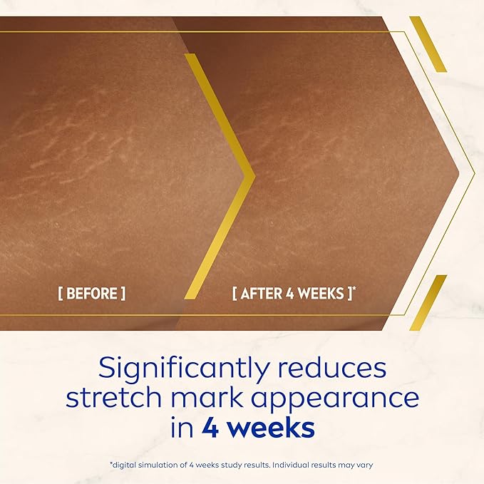 Nivea كريم نيفيا لومي نوس 630 المضاد لعلامات التمدد والبقع الداكنة 200 مل كريم مرطب لمدة 48 ساعة يقلل من علامات التمدد والبقع الشمسية والبقع الصبغية - Image 3