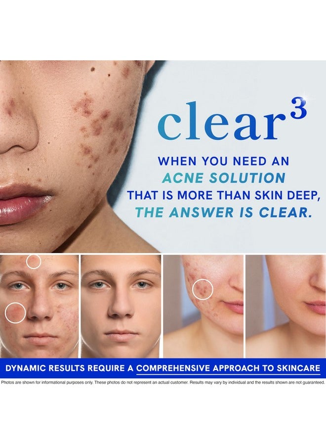 SMNutrition - Clear Skin Acne Supplement with Zinc, DIM & Probiotics | 3-in-1 Balance, Clarify, Restore Support with Hyaluronic Acid & Other Anti-Acne Vitamins | for Women & Men | Oral Hormonal Acne Pills | 60ct - Image 1