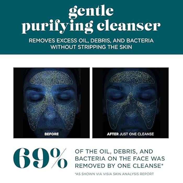 VI DERM Gentle Purifying Cleanser – Hydrating Water-Based Face Wash for Women & Men – Gentle Moisturizing Facial Cleanser with Aloe Vera, Vitamin E & Willow Bark Extract – Fragrance Free, 4 Fl Oz - Image 5