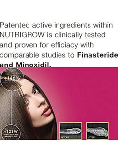 Nutrigrow Anti Hair Loss & Faster Growth Shampoo For Dry & Normal Hairs (300Ml)  - Image 5
