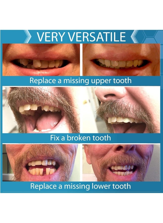 Instant Smile Complete Your Smile Tooth Replacement Kit DELUXE PACK Includes Patented Complete Your Smile Tooth Replacement Kit and Jar of Instant Smile Replacement Beads - Image 4