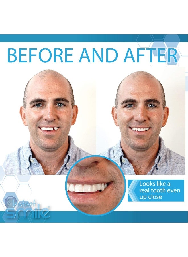 Instant Smile Complete Your Smile Tooth Replacement Kit DELUXE PACK Includes Patented Complete Your Smile Tooth Replacement Kit and Jar of Instant Smile Replacement Beads - Image 3