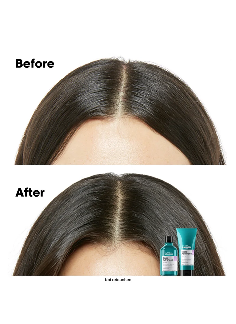 L'Oréal Professionnel L’Oréal Professionnel│Scalp Advanced: Anti-discomfort Glacial Utopia Duo Set | Shampoo 300ml & Treatment 200ml | SERIE EXPERT