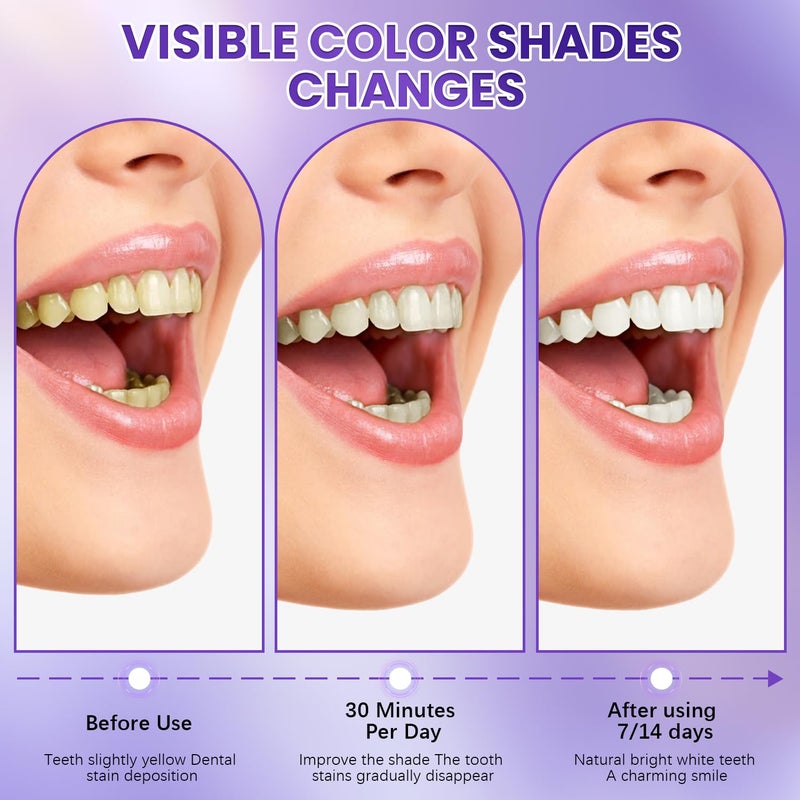 Botou 2PCS Purple Teeth Whitening Strips, Enamel Safe for Sensitive Tooth, Coffee & Smoking Deep Stain Power Removal, Residue-Free Non-Slip, Professional Treatments(14Pairs) - Image 2