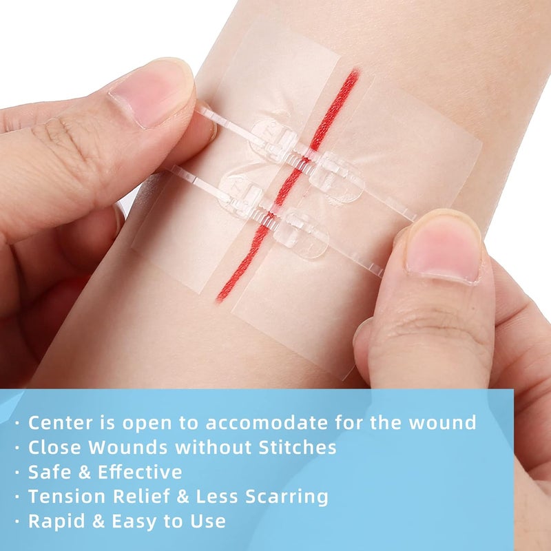 LotFancy Emergency Wound Closures 4Count First Aid Supplies Medical Butterfly Bandaids Surgical Sutures Laceration Repair Kit with Accessories Sterile LatexFree - Image 2