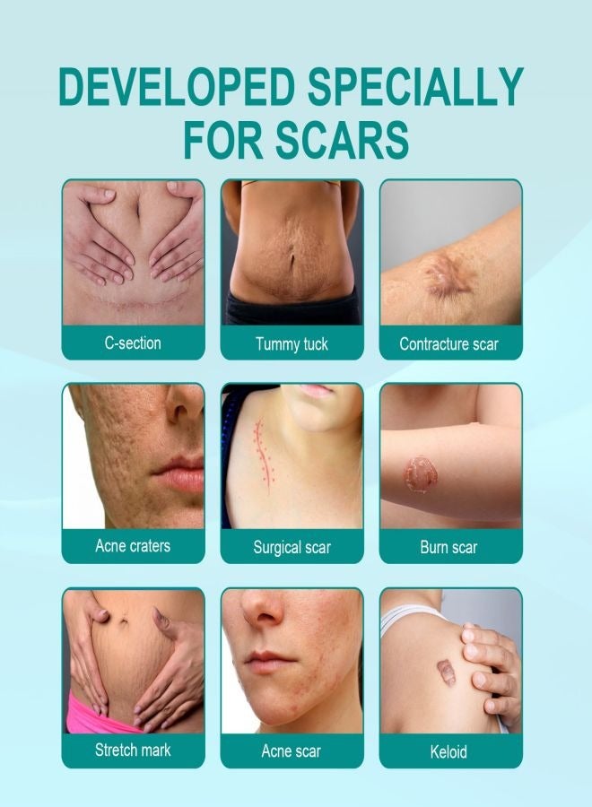 SOUTH MOON Medical Grade Scar Spray for Reduce Scars and Smooth Skin  - Image 3