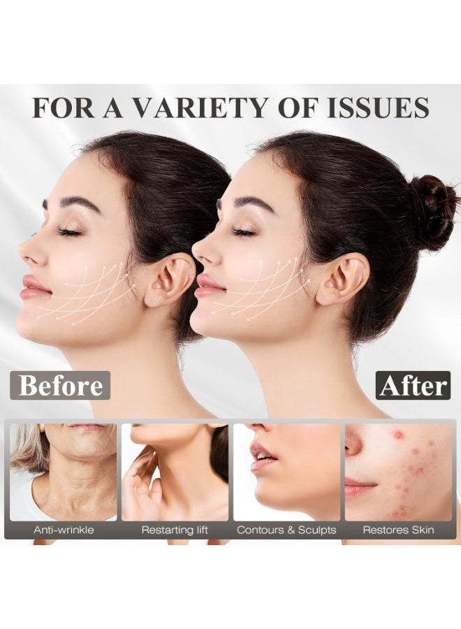 Bukela Chin Strap for Sleeping, Adjustable Chin Strap, Jaw Strap, Jawline Shaper, V Line Lifting Mask, Black - Image 3