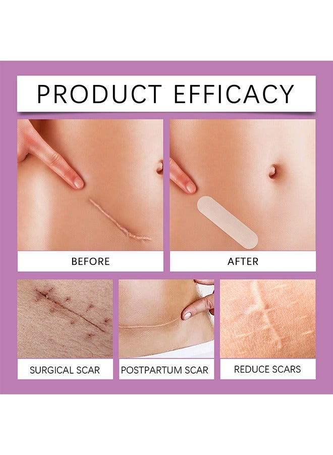LANISKA Soothing Silicone Scar Patches，Silicone Scar Tape，Reusable Professional Scar Silicone Strips, Soft Silicone Scar Sheets for Surgical Scars,Keloid,Acne Scars,Burn Scar,C-Section  6 PIECES - Image 3