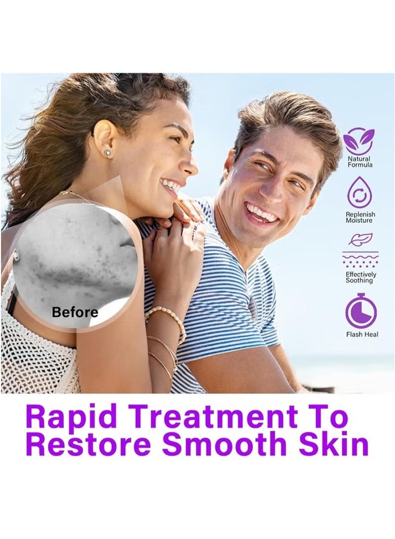 SKIN Azelaic Acid Serum, Azelaic Acid 12% Cream，Hyaluronic Acid and Niacinamide, Relieves Redness, Dark Spots, Rosacea, Balances Excess Sebum, Brightening Face Skin Care Treatment for All Skin Types 20g - Image 5