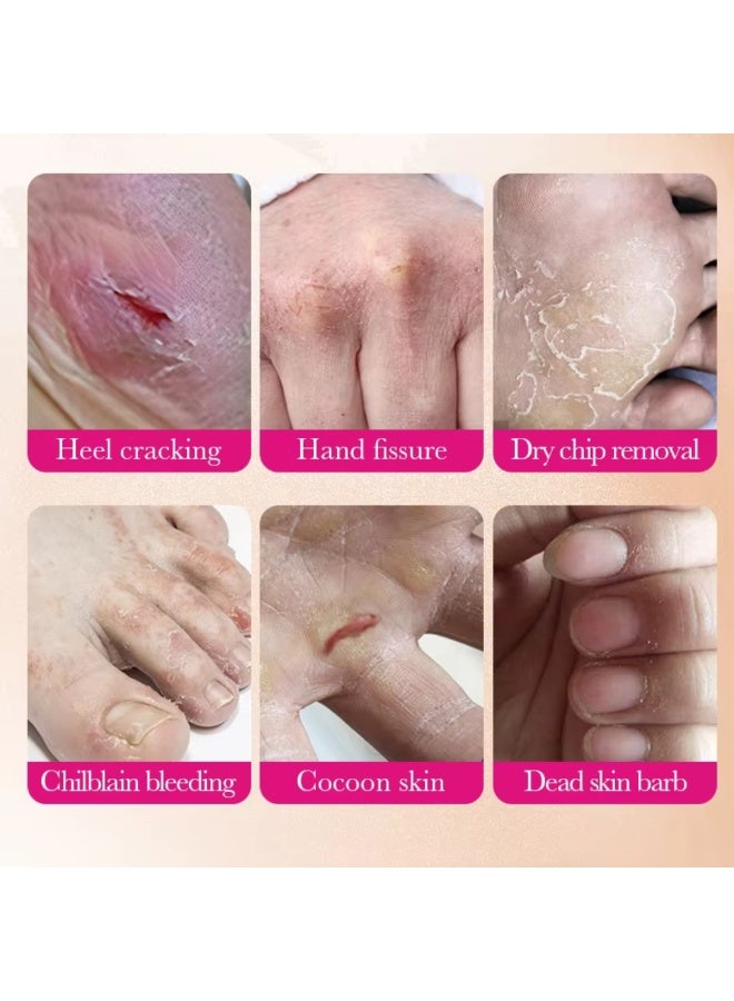 SADOER Anti Crack Squalane Peach Foot Repair Cream 70G Multi Action 4 in 1 Anti Drying Deep Hydration Repairing And Anti-Crack Soothing Foot Cream 98% Natural Ingredients Foot Repair Cream - Image 5