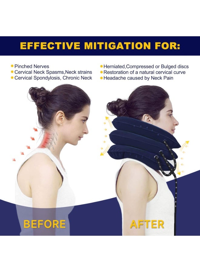 يلا جوي جهاز شد الرقبة، أفضل دعامة لتخفيف آلام عنق الرحم، جهاز شد الرقبة والدعم، جهاز رائع لتخفيف توتر عنق الرحم، وأجهزة شد الرقبة للاستخدام المنزلي والمكتبي - Image 4