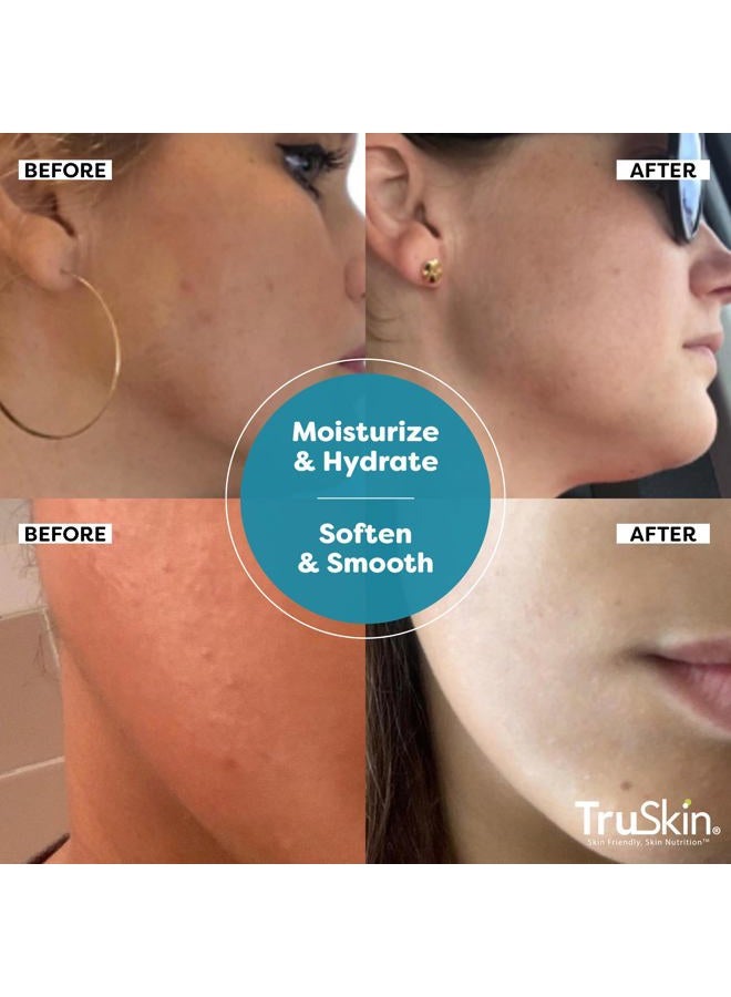 TruSkin Hyaluronic Acid Serum for Face + 7 Ultra Hydrating Ingredients – Best Face Serum for Moisturizing, Visibly Plumping Skin & Smoothing the Look of Fine Lines, 1 fl oz - Image 5