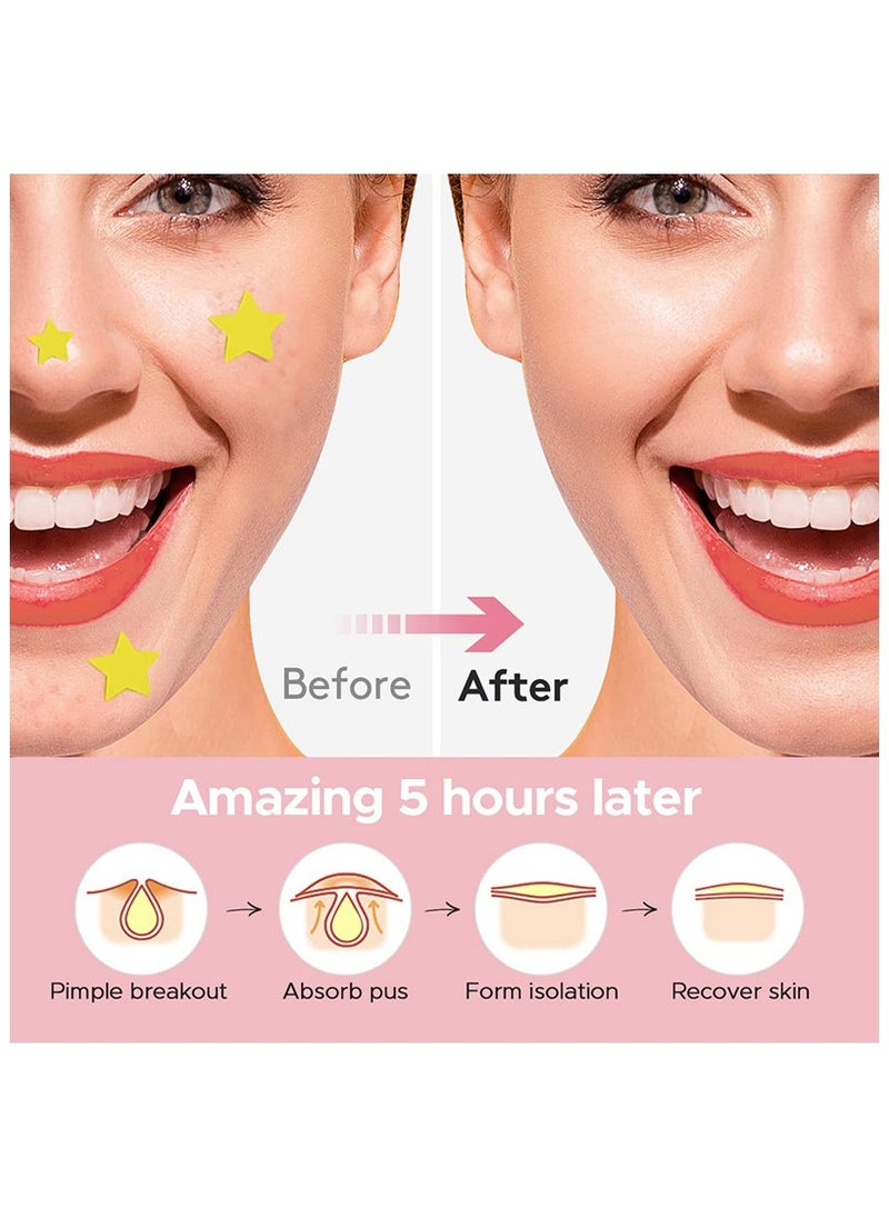 Acne patch - 600 Count Pimple Patch, Acne Covering Stickers For Face And Skin, For Men And Women Daily Skin Care - Image 1