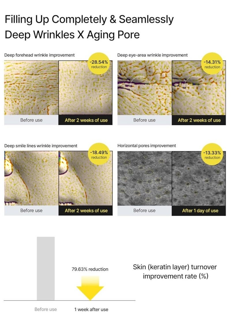 سيليماكس مُعزِّز رفع فيتا أ ريتي نال شوت | مع ريتينول ليبوسوميو، ماتريكسيل، مُصغِّر المسام، تجاعيد وخطوط دقيقة، بشرة أكثر ثباتًا، 15 مل - Image 4