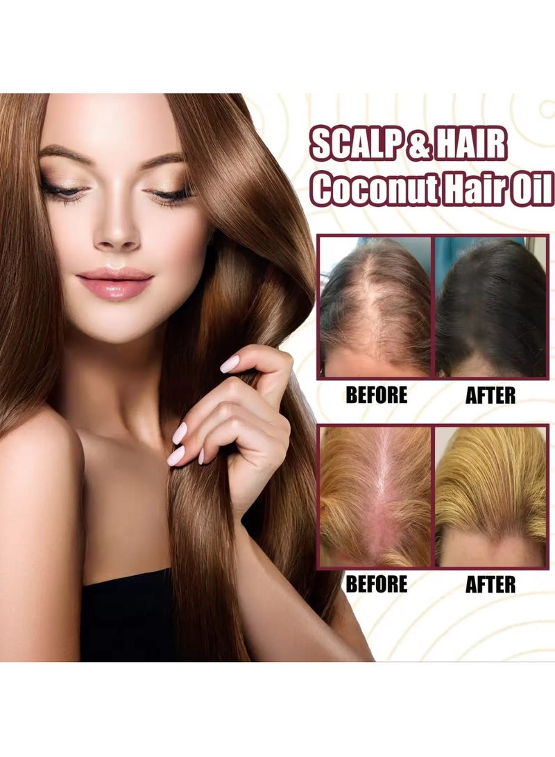 OUHOE زيت البصل الأحمر 2 قطعة مضاد للتساقط إصلاح الضرر تعزيز نمو الشعر زيت أساسي زيت شعر معزز زيت البصل الأحمر زيت طبيعي فعال لنمو الشعر زيت للشعر اللامع - Image 5