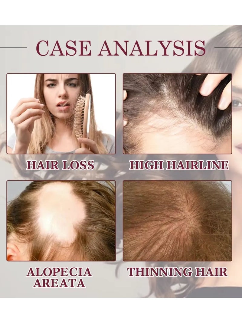 OUHOE زيت البصل الأحمر 2 قطعة مضاد للتساقط إصلاح الضرر تعزيز نمو الشعر زيت أساسي زيت شعر معزز زيت البصل الأحمر زيت طبيعي فعال لنمو الشعر زيت للشعر اللامع - Image 3