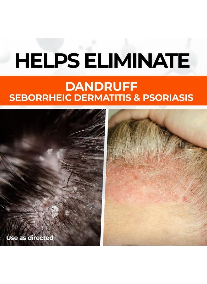 Medicasp - Medicasp Coal Tar Gel Dandruff Shampoo to Treat Seborrheic Dermatitis Psoriasis 3 Pack 6 oz - Image 1