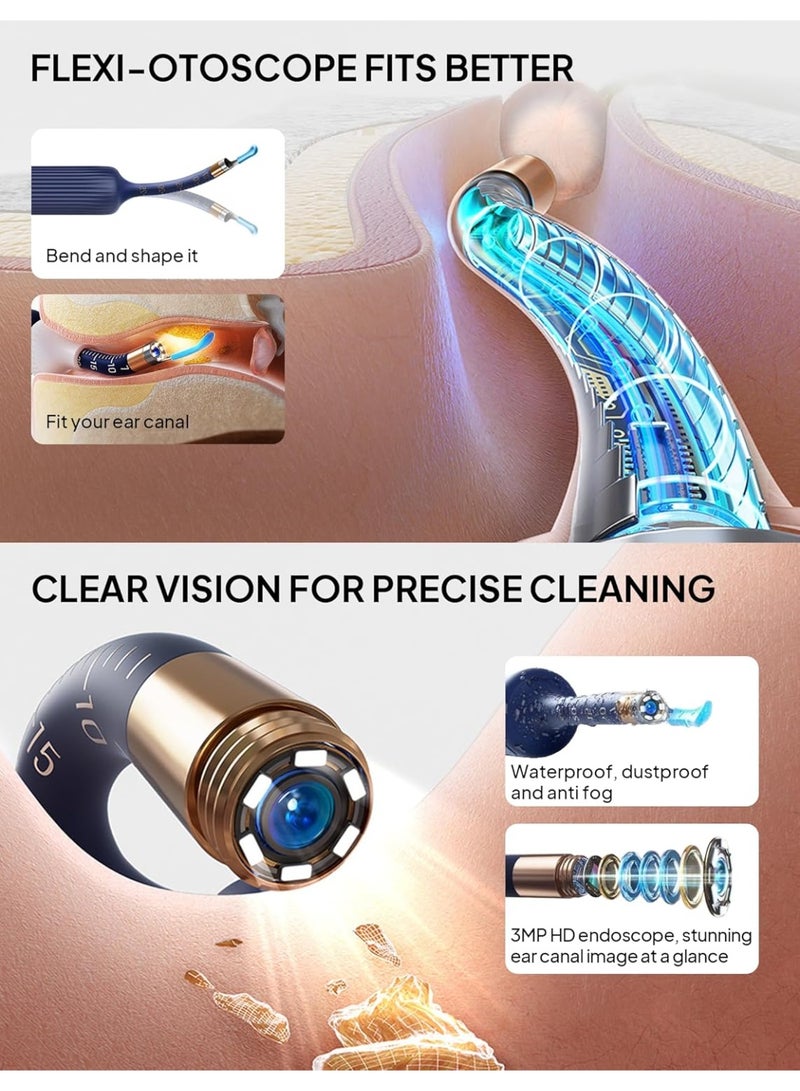 كيلا إزالة شمع الأذن، ملعقة إزالة الشمع المرئي عبر شبكة Wi-Fi، منظار أذن لاسلكي بدقة 1296 بكسل عالية الدقة مع ضوء LED لأجهزة iPhone وiPad وهواتف Android - Image 5