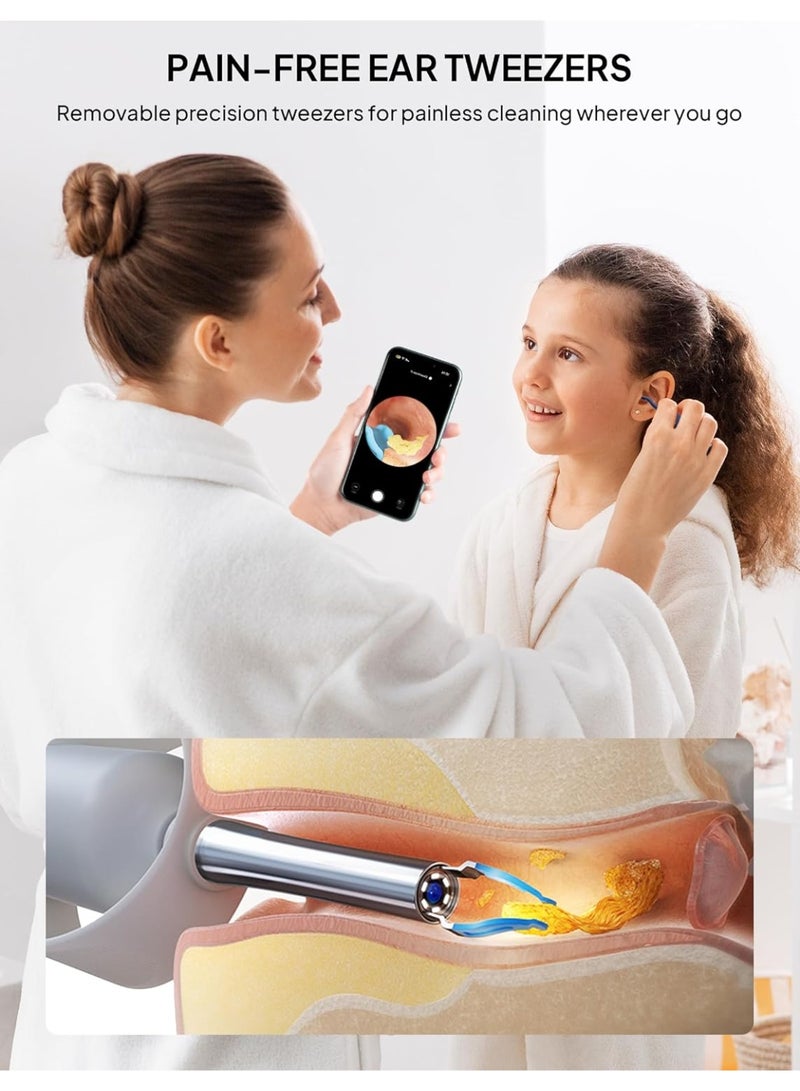 كيلا إزالة شمع الأذن، ملعقة إزالة الشمع المرئي عبر شبكة Wi-Fi، منظار أذن لاسلكي بدقة 1296 بكسل عالية الدقة مع ضوء LED لأجهزة iPhone وiPad وهواتف Android - Image 2