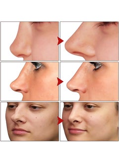 Nose Essential Oil Up Heighten Rhinoplasty Collagen Firming Moisturizing Perfect Nose Serum Reshape Natural Beauty Skin Care - pzsku/ZDB6867201574D7F1A5B4Z/45/_/1718847228/31eca8f0-9aaf-4312-a0dc-1389ceac6b70