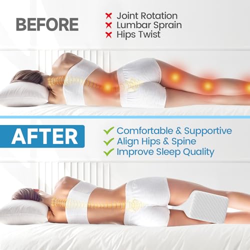 TranquilRelax Knee Pillow for Side Sleepers, Leg Pillow for Side Sleeping, Smooth Pillow for Spine Aligning, Comfortable Memory Foam Pillow for Hip, Back, Sciatica, Knee, Joints Pain (White) - Image 4