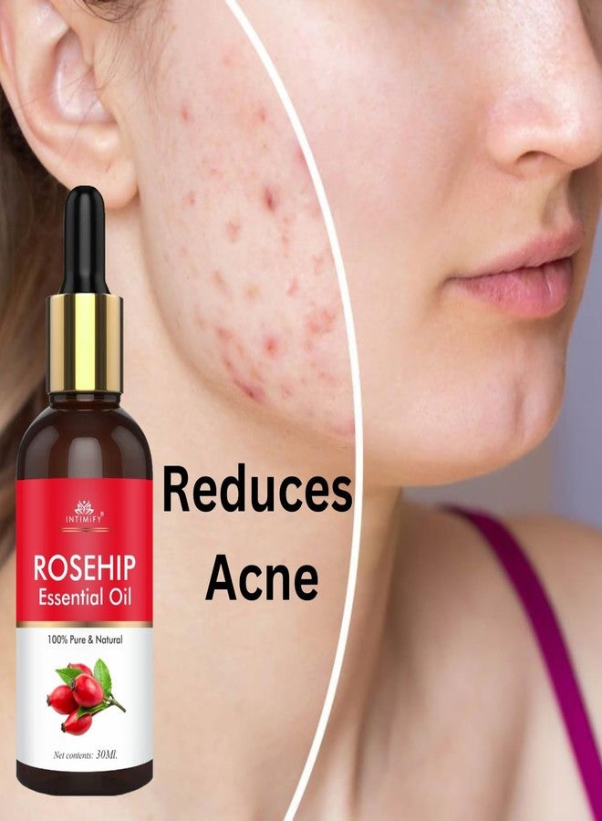 INTIMIFY Rosehip Oil For Face | Face Oil For Glowing Skin and Hair Growth | All Skin Types | Cold Pressed & Therapeutic Grade Carrier Oil | For Men & Women | 30 ml - Image 3