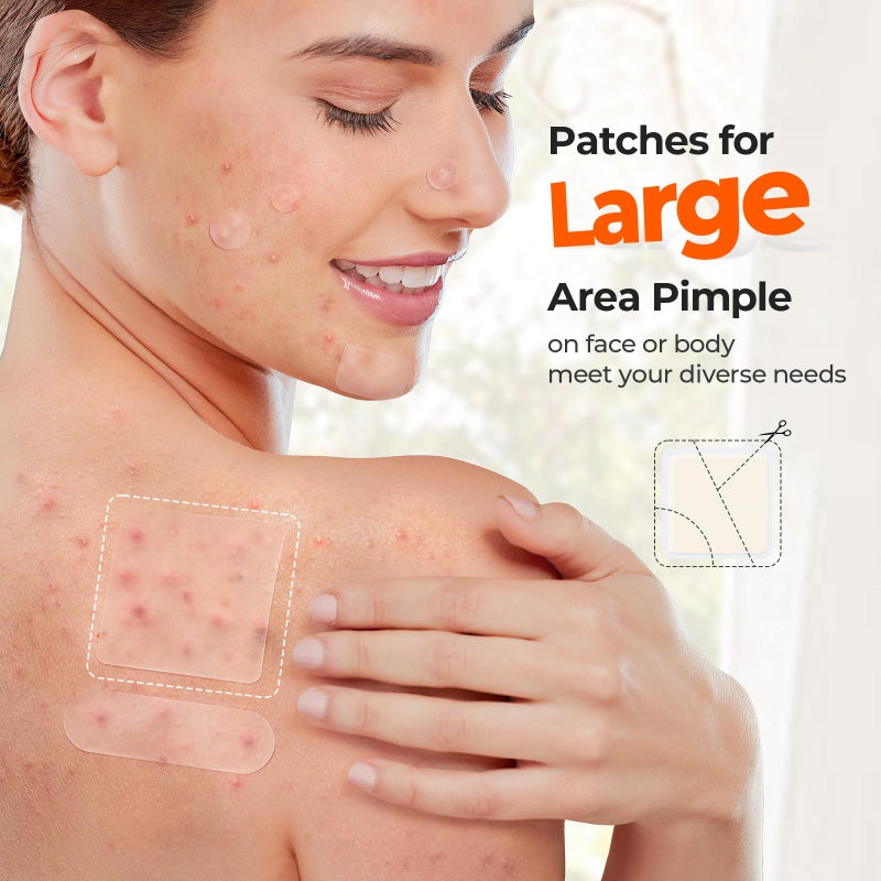 TKTK Hydrocolloid Bandages, 45 x 45 mm Large Pimple Patches for Face, XL Acne Patches for Body, Back, Forehead, Cheek Zit Breakouts, Big Hydrocolloid Patch (Square, Strip, Dot 5 Sizes 120 Count) - Image 3