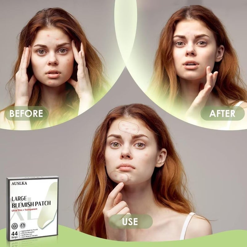 AUSLKA Blemishes Patches - 44 Strips, Hydrocolloid Dots - Large Blemishes Patch - Blemishes Stickers - Zit Breakouts - Suitable for Larger Area Outbreaks - Image 3