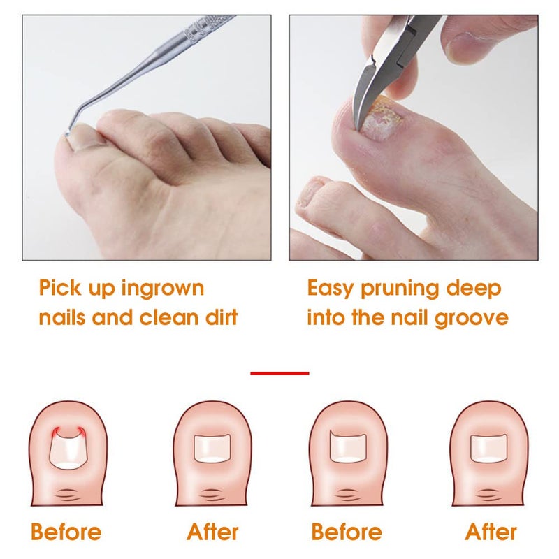 M'AYCREATE ® Ingrown Toenail Clippers for Ingrown or Thick Toenails,Wide Jaw Opening Nail Clippers with Curved and Slant Straight Blade Edge, 6 PCS Stainless Steel Toe Nail Clipper for Men - Image 4