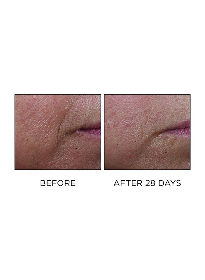 Perricone MD Cold Plasma Plus+ Advanced Serum Concentrate, 1 fl Oz - Image 3