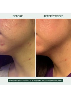 FACETORY FACETORY Urban Calm Barrier Cream Moisturizer with Hyaluronic Acid - Face Lotion with Fermented Honeybush - Hydrating Rich Water Gel for Dry, Oily & Sensitive Skin  - Image 3