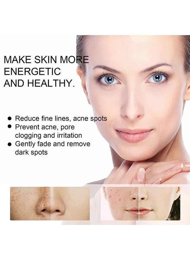 EELHOE Whitening Freckle Cream,Pigmentation Removal Cream for Face,Freckle Remover Cream,Moisturizing Anti-blemish Cream,Dark Spots Remover Skin Whitening (20g)  - Image 5